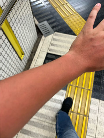 日焼け